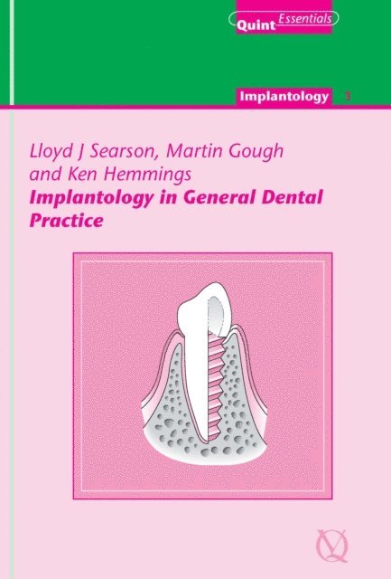 Ken Hemmings, Martin Gough, Lloyd J. Searson - Implantology in General Dental Practice, E-bok. Tillgänglighet: Lägg i varukorg