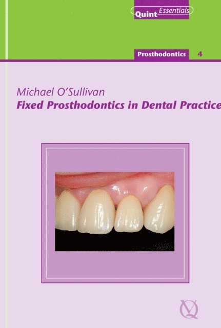 Michael O'Sullivan - Fixed Prosthodontics in Dental Practice, E-bok
