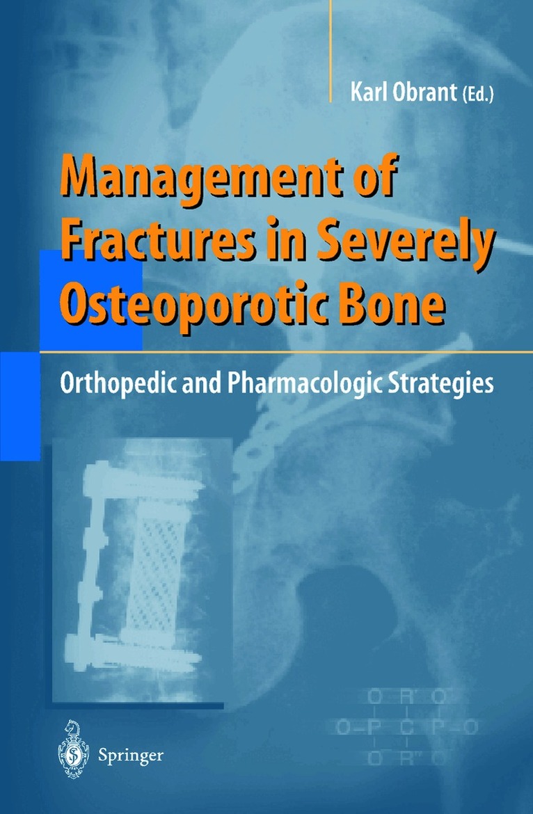 Karl Obrant - Management of Fractures in Severely Osteoporotic Bone, Inbunden