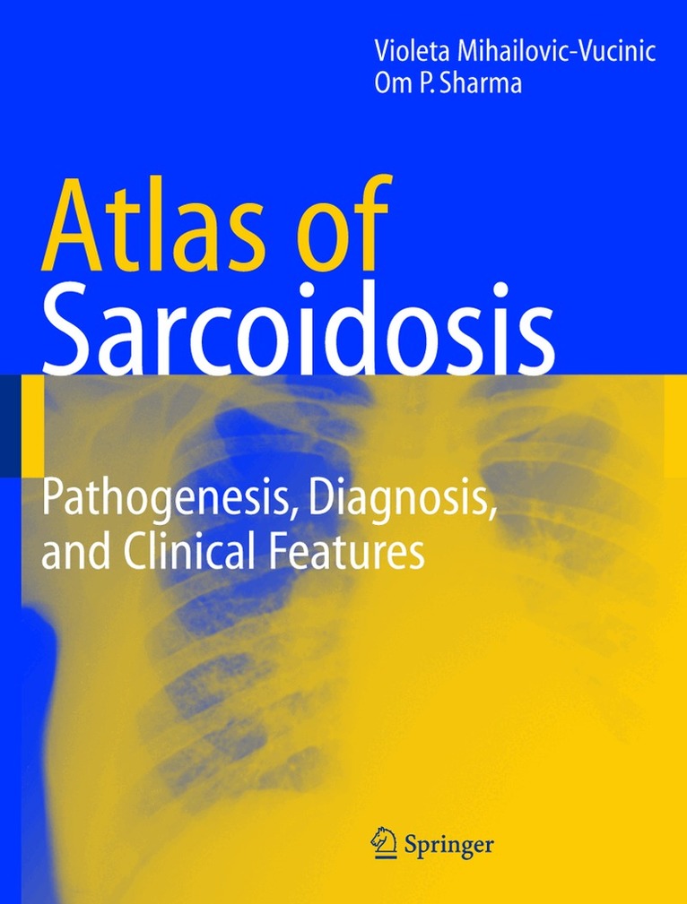 Violeta Mihailovic-Vucinic, Om P. Sharma - Atlas of Sarcoidosis, Inbunden