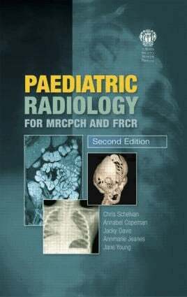 Christopher Schelvan, Copeman Copeman, Jacqueline Davis, Annmarie Jeanes, Jane Young, Christopher Schelvan, Annabel Copeman, Jacqueline Davis, Annmarie Jeanes, Jane Young - Paediatric Radiology for MRCPCH and FRCR, Second Edition, Häftad