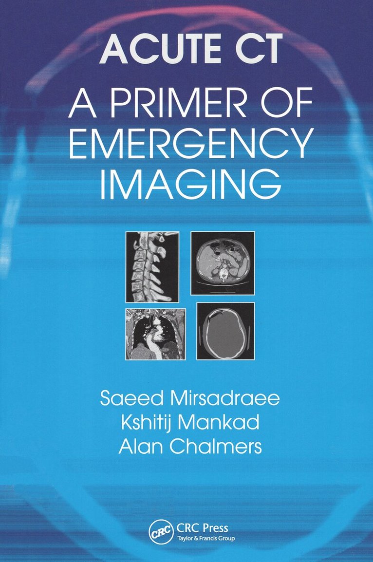 Saeed Mirsadraee, Kshitij Mankad, Alan Chalmers - Acute CT: A Primer of Emergency Imaging, Häftad