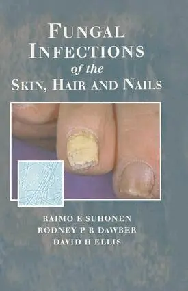 Raimo E. Suhonen, Rodney P.R. Dawber, David H. Ellis - Fungal Infections of the Skin and Nails, Inbunden. Tillgänglighet: Lägg i varukorg