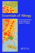 Essentials of Allergy