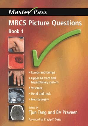 Tjun Tang, B V Praveen - MRCS Picture Questions, Häftad. Tillgänglighet: Tillfälligt slut