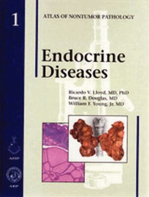 Ricardo V. Lloyd, Bruce R. Douglas, William F. Young Jr - Endocrine Diseases, Inbunden. Tillgänglighet: Tillfälligt slut