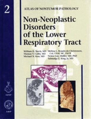 William D. Travis, Thomas V. Colby, Michael N. Koss, M.L. Rosado-de-Christensen - Non-Neoplastic Disorders of the Lower Respiratory Tract, Inbunden. Tillgänglighet: Tillfälligt slut