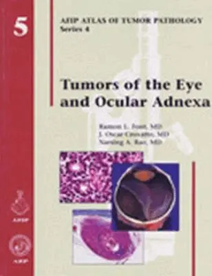 Ramon L. Font, J. Oscar Croxatto, Narsing A. Rao - Tumors of the Eye and Ocular Adnexa, Inbunden. Tillgänglighet: Tillfälligt slut