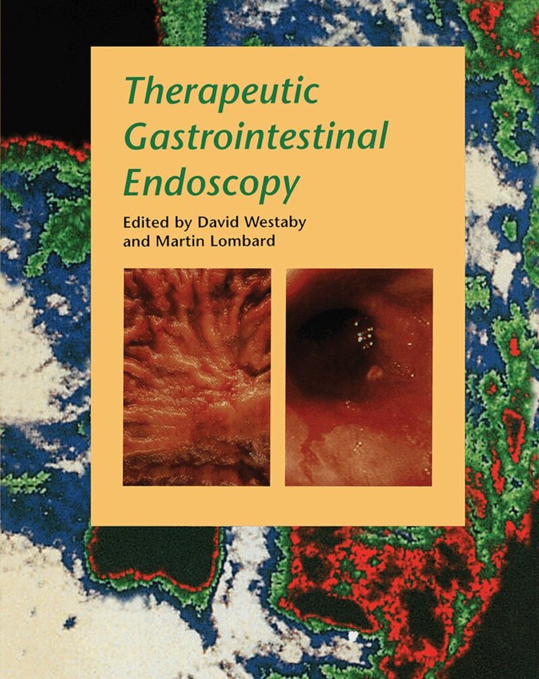 David Westaby, Martin Lombard - Therapeutic Gastrointestinal Endoscopy, Inbunden. Tillgänglighet: Lägg i varukorg