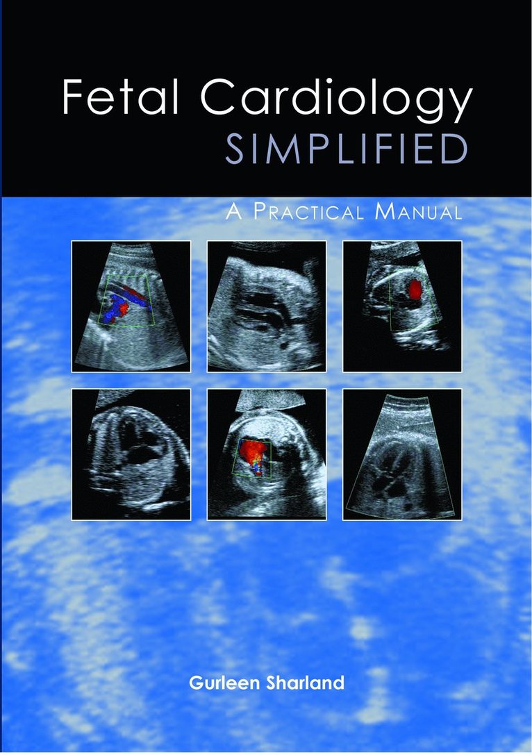 Gurleen Sharland - Fetal Cardiology Simplified, Häftad