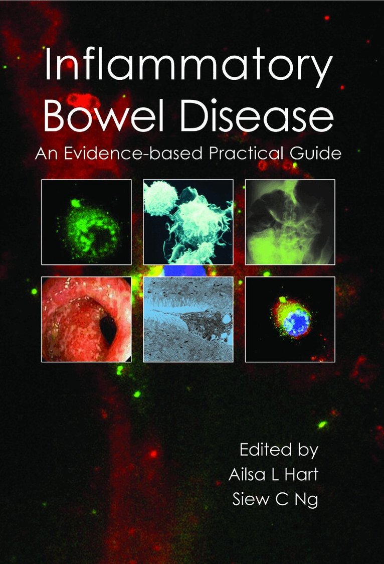 Ailsa L Hart, Siew C Ng - Inflammatory Bowel Disease, Häftad