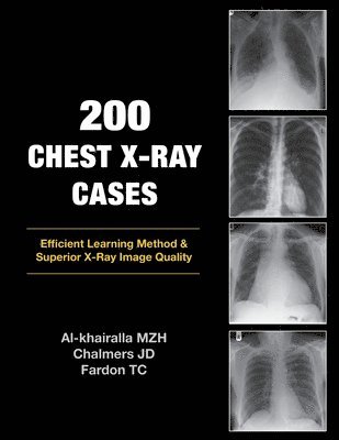 Mudher Al-khairalla, James Chalmers, Tom Fardon - 200 Chest X-Ray Cases, Häftad