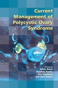 Current Management of Polycystic Ovary Syndrome