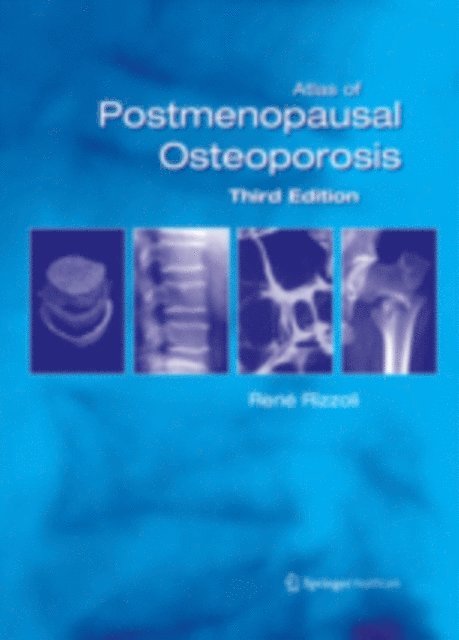 Rene Rizzoli - Atlas of Postmenopausal Osteoporosis, E-bok