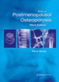 Atlas of Postmenopausal Osteoporosis