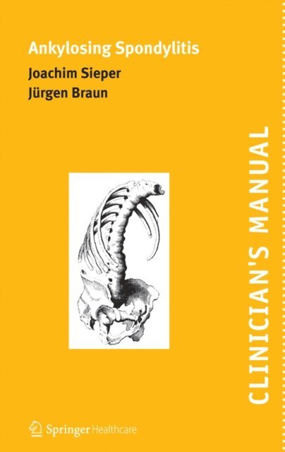 Jurgen Braun, Joachim Sieper - Clinician's Manual on Ankylosing Spondylitis, E-bok