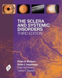 Sclera and Systemic Disorders