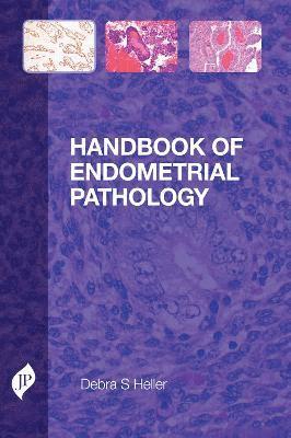 Debra S. Heller - Handbook of Endometrial Pathology, Häftad