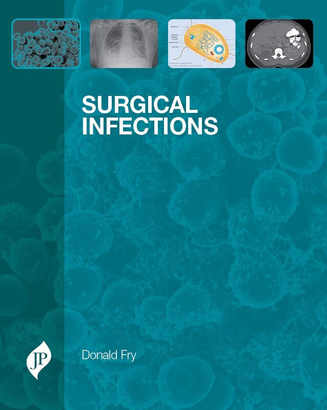 Donald Fry - Surgical Infections, Inbunden