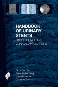 Handbook of Urinary Stents