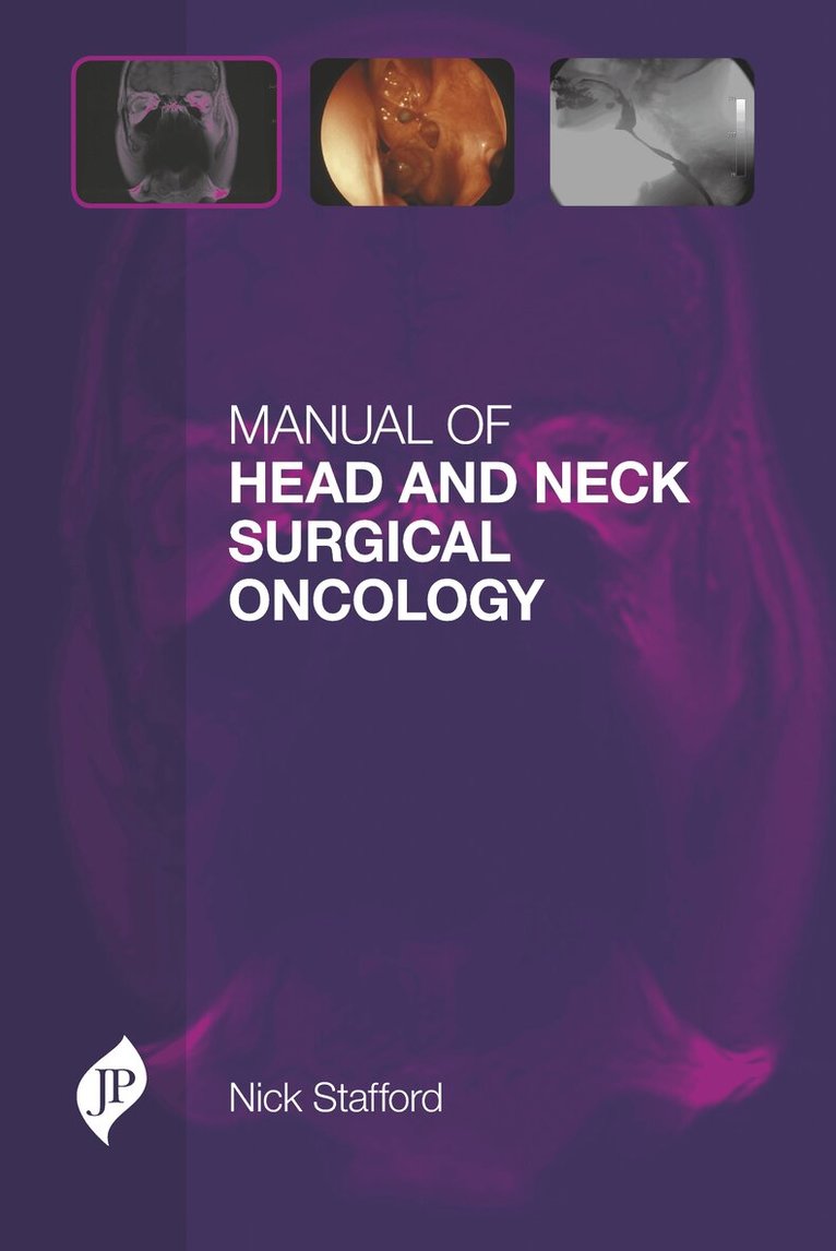 Nick Stafford - Manual of Head and Neck Surgical Oncology, Inbunden. Tillgänglighet: Lägg i varukorg
