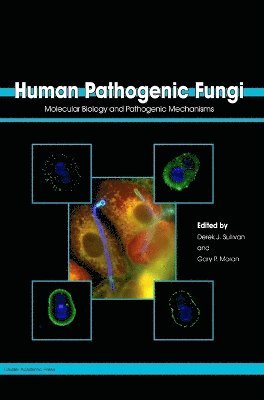 Derek J. Sullivan, Gary P. Moran - Human Pathogenic Fungi, Inbunden