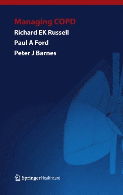 Peter Barnes, Paul Ford, Richard Russell - Managing COPD, E-bok