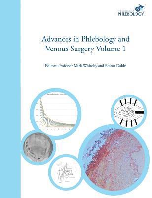 Mark S. Whiteley, Emma B. Dabbs - Advances in Phlebology and Venous Surgery Volume 1, Inbunden