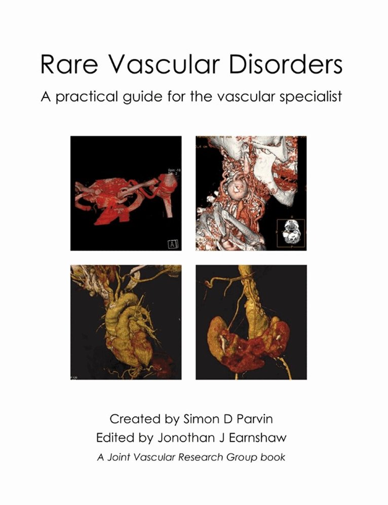 Simon D. Parvin, Jonothan J. Earnshaw - Rare Vascular Disorders, E-bok