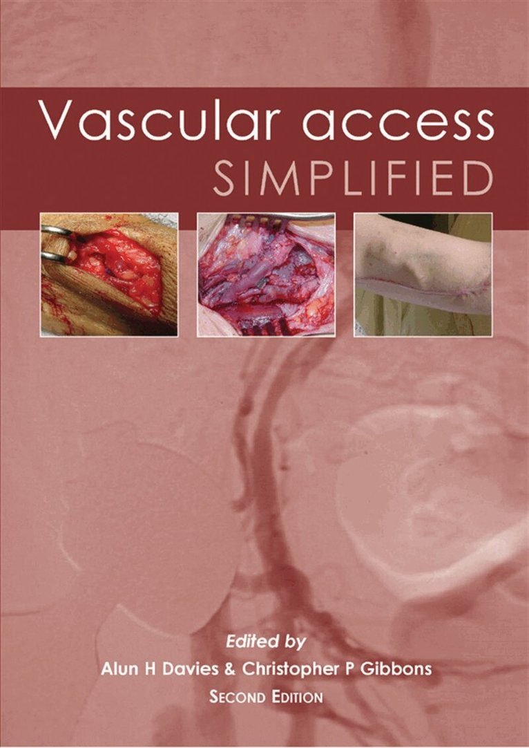 Alun H. Davies, Christopher P. Gibbons - Vascular Access Simplified; second edition, E-bok