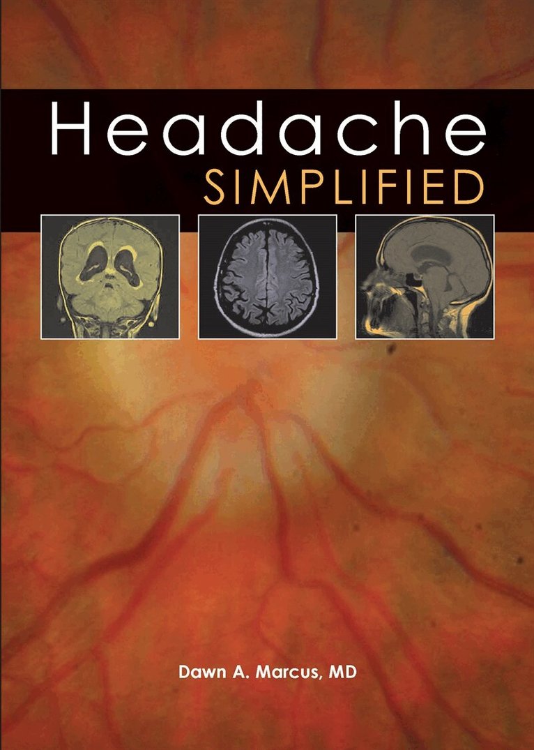Dawn A. Marcus - Headache Simplified, E-bok