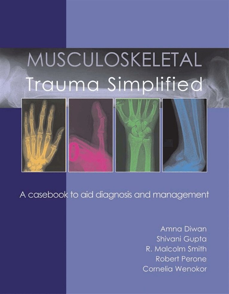 Amna Diwan, Cornelia Wenokor, Shivani Gupta, Richard W. Perone, Malcolm R. Smith - Musculoskeletal Trauma Simplified, E-bok