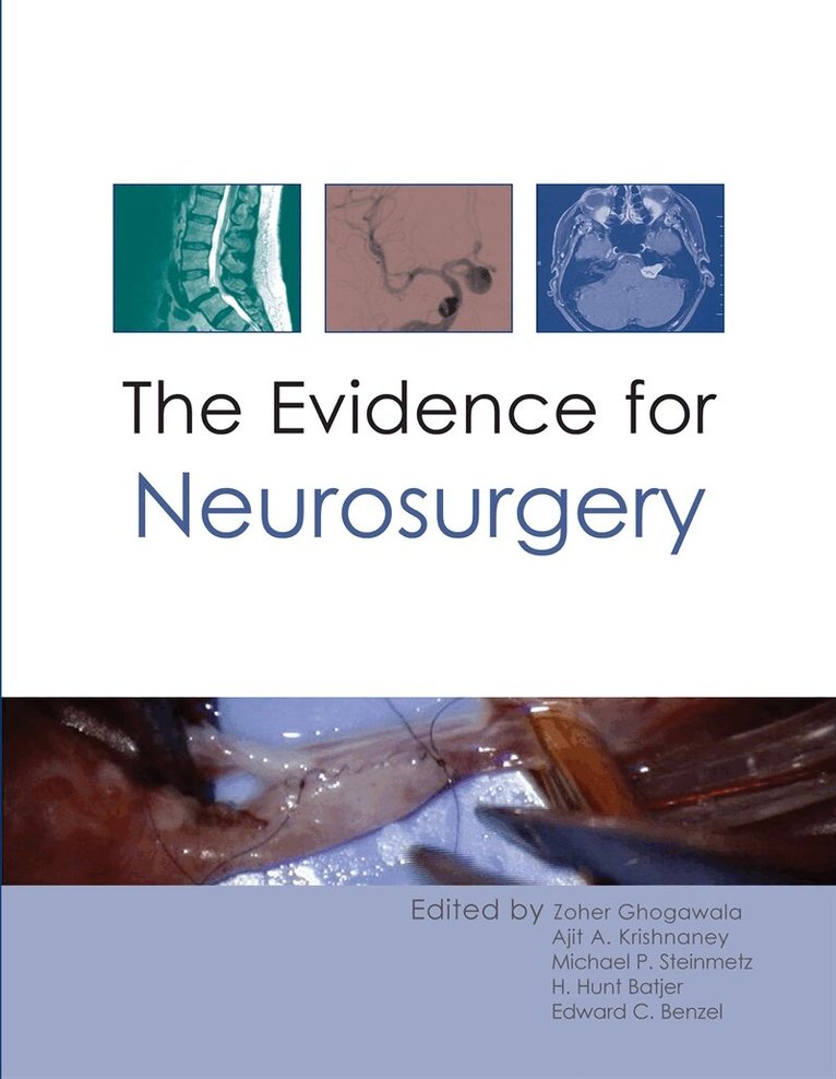 Zoher Ghogawala, H. Hunt Batjer, Ajit A. Krishnaney, Michael P. Steinmetz, Edward C. Benzel - The Evidence for Neurosurgery, E-bok