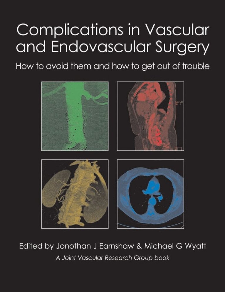 Jonothan J. Earnshaw, Michael G. Wyatt - Complications in Vascular and Endovascular Surgery, E-bok