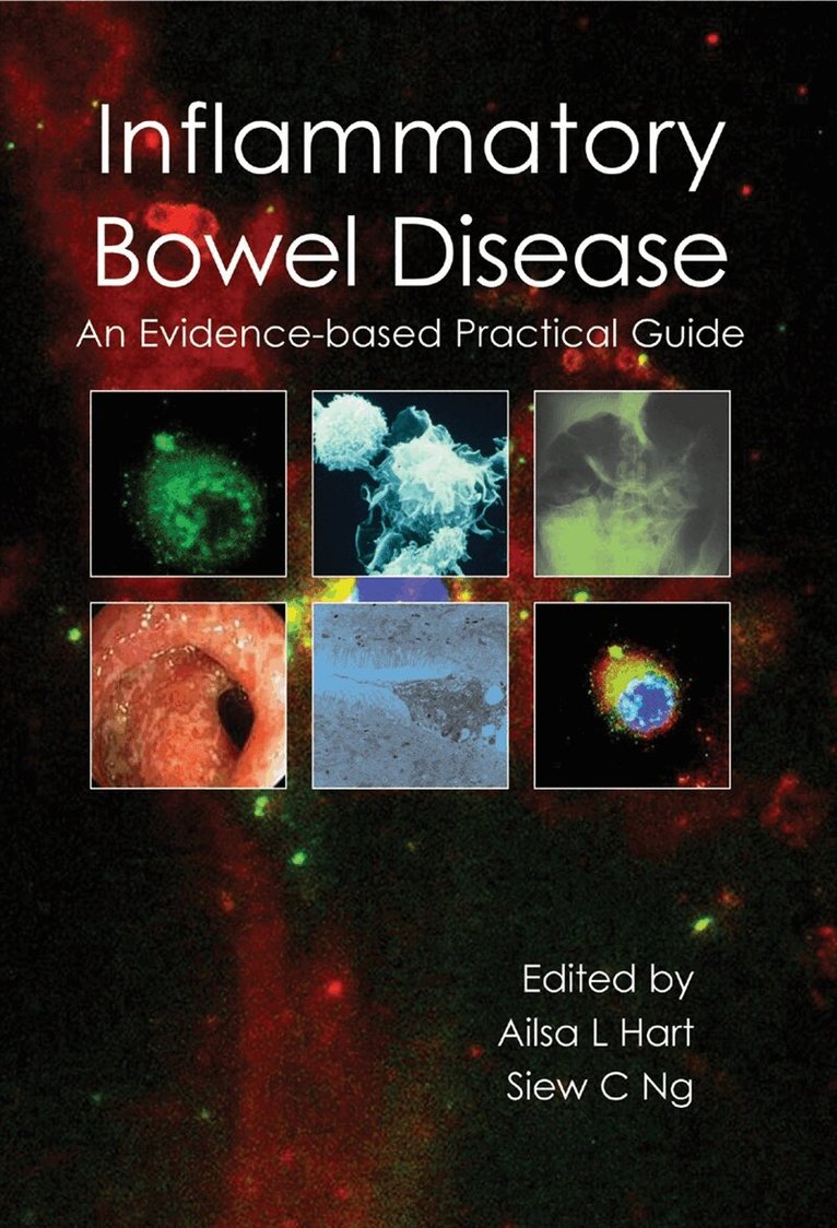Ailsa L. Hart, Siew C. Ng - Inflammatory Bowel Disease, E-bok. Tillgänglighet: Lägg i varukorg