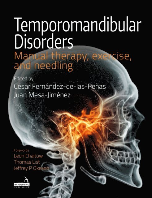 César Fernández-de-las-Peñas - Temporomandibular Disorders, E-bok