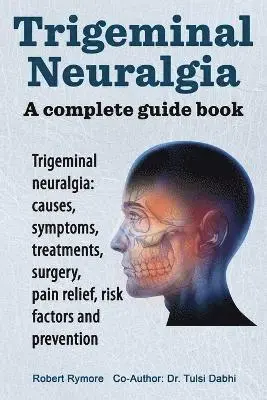 Robert Mymore - Trigeminal Neuralgia, Häftad. Tillgänglighet: Lägg i varukorg