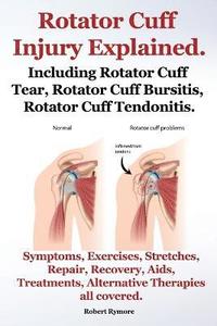 Rotator Cuff Injury Explained. Including Rotator Cuff Tear, Rotator Cuff Bursitis, Rotator Cuff Tendonitis. Symptoms, Exercises, Stretches, Repair, Recovery, Aids, Treatments, Alternative Therapies
