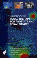 Handbook of Focal Therapy for Prostate and Renal Cancer