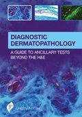 Diagnostic Dermatopathology: A Guide to Ancillary Tests Beyond the H&E