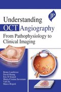 Understanding OCT Angiography