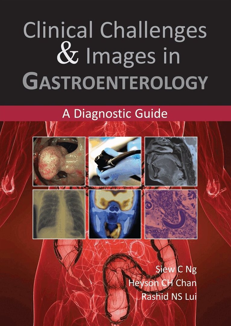 Siew C NG, Heyson CH Chan, Rashid NS Lui - Clinical Challenges & Images in Gastroenterology, E-bok. Tillgänglighet: Lägg i varukorg