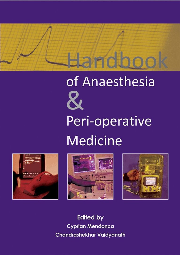 Cyprian Mendonca, Chandrashekhar Vaidyanath - Handbook of Anaesthesia & Peri-operative Medicine, E-bok