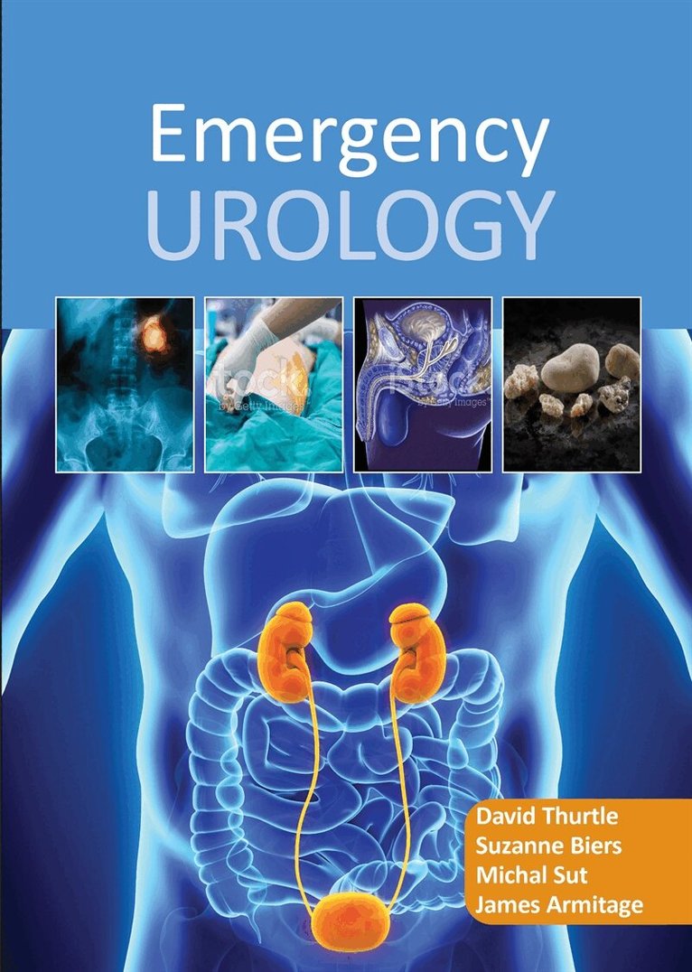 David Thurtle, Suzanne Biers, Michal Sut, James Armitage - Emergency Urology, E-bok