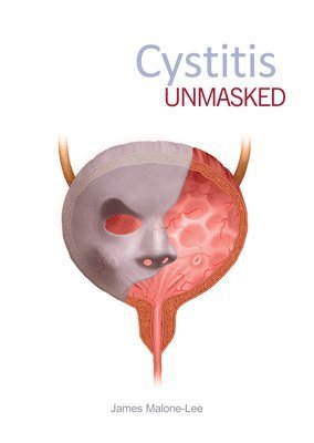 Cystitis Unmasked av James Malone-Lee, James Malone-Lee