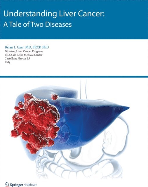 Brian I. Carr - Understanding Liver Cancer, E-bok