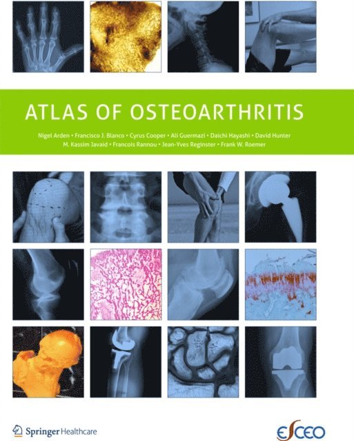 Jean-Yves Reginster, Frank Roemer, Francois Rannou, M. Kassim Javaid, David Hunter, Daichi Hayashi, Ali Guermazi, C. Cooper, Francisco Blanco, Nigel Arden - Atlas of Osteoarthritis, E-bok