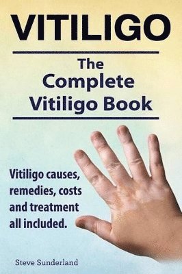 Steve Sunderland - Vitiligo. Vitiligo causes, remedies, costs and treatment all included. The complete Vitiligo Book., Häftad