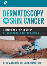 Dermatoscopy and Skin Cancer