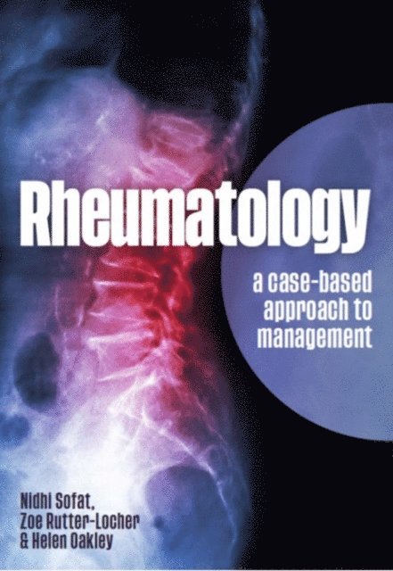 Helen Oakley, Zoe Rutter-Locher, Nidhi Sofat - Rheumatology, E-bok